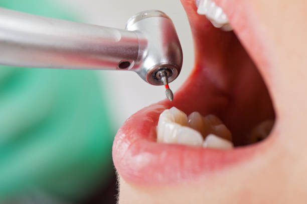 Best After-Hours Emergency Dentist in Goliad, TX